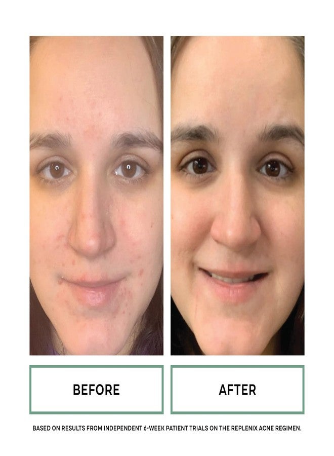 ريبلينكس مناديل ريبلينكس غلي-سال المنقية للبشرة المعرضة لحب الشباب، 60 منديلًا، مناديل مقشرة طبية تحتوي على حمض الجليكوليك و2% من حمض الساليسيليك للبشرة المعرضة لحب الشباب، تساعد على إزالة الشوائب وتصغير المسام، غير دهنية - Image 5